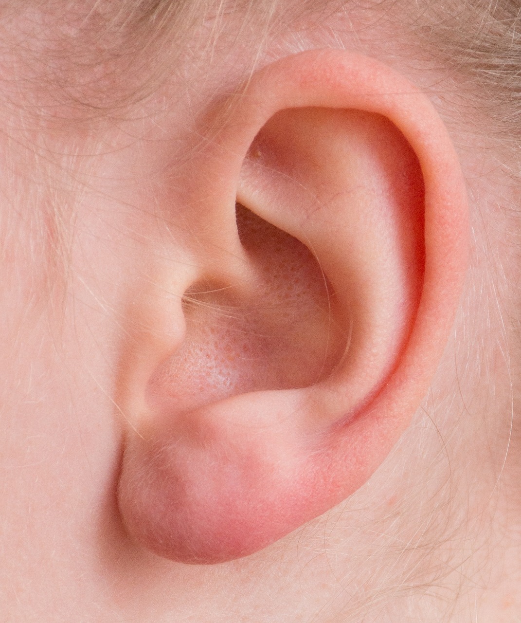 Tinnitus: Was hilft sofort?