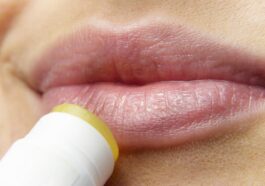 Was hilft gegen Herpes?